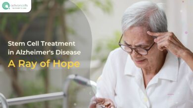 Stem-Cell-Treatment-in-Alzheimers-Disease-Advancells